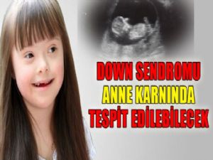 DOWN SENDROMUNA ANNE KARNINDA TESPİT